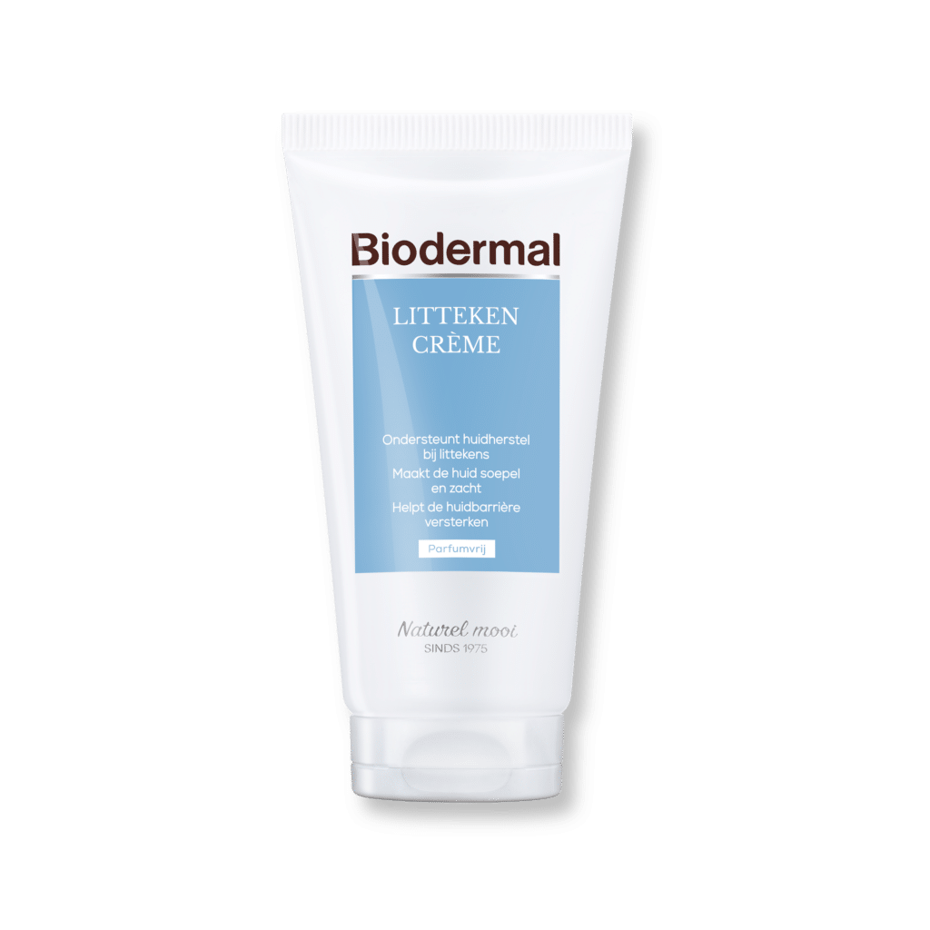 Littekencrème